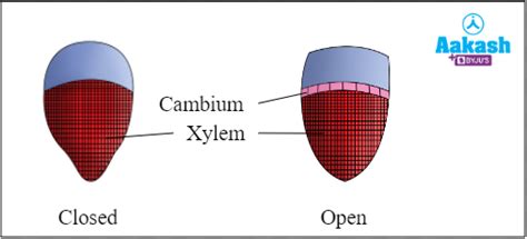 Plant Vascular System, Vascular Bundles Types & Differences | AESL