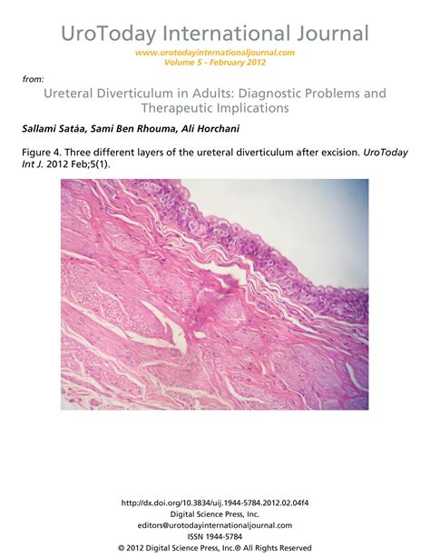 Ureteral Diverticulum in Adults: Diagnostic Problems and Therapeutic Implications