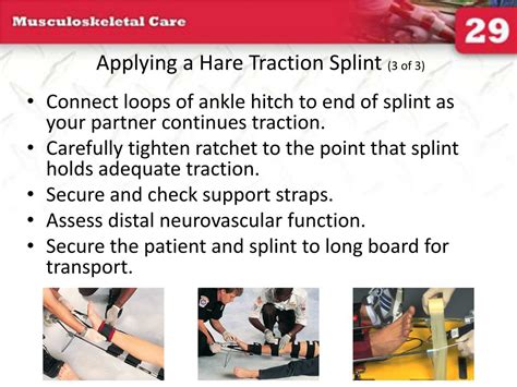 Hare Traction Splint Application 的图像结果