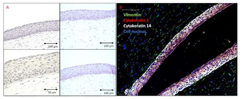 A Simple Method for the Production of Human Skin Equivalent in 3D ...