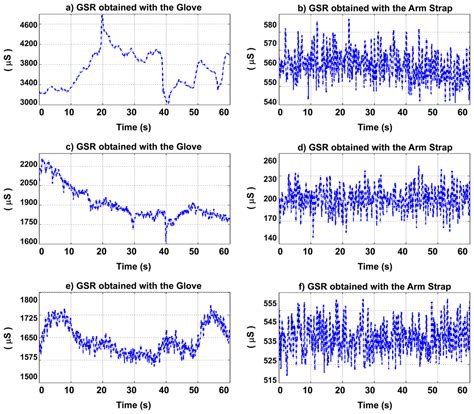Sensorized Garments and Textrode-Enabled Measurement Instrumentation ...