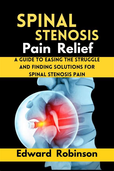 Buy Spinal Stenosis Pain : A guide to Easing the struggle And Finding ...