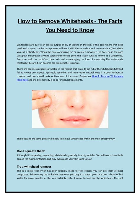 How To Get Rid Of Whiteheads