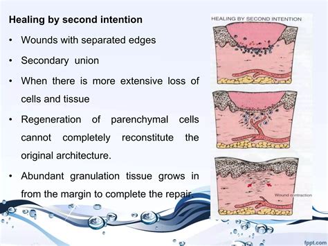 Wound healing | PPTX