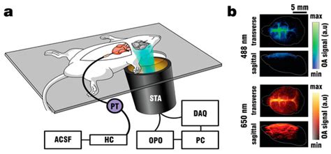 Photonics | Special Issue : Neurophotonics – Optics for the Brain