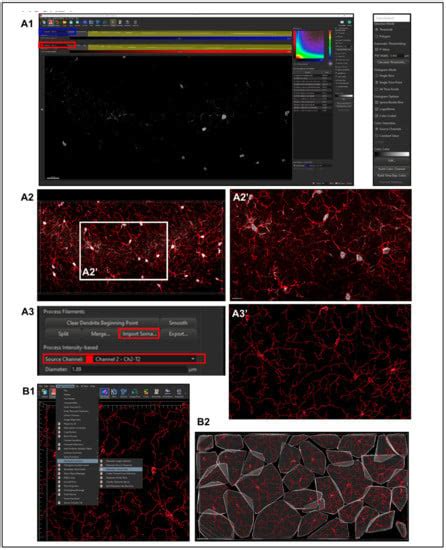 Unbiased Quantitative Single-Cell Morphometric Analysis to Identify ...