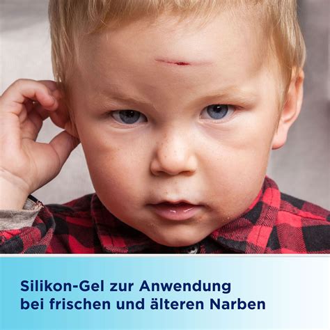 BEPANCARE Narben-Gel 20 ml - Narbenpflege - Wundheilung - Haut - Haut ...