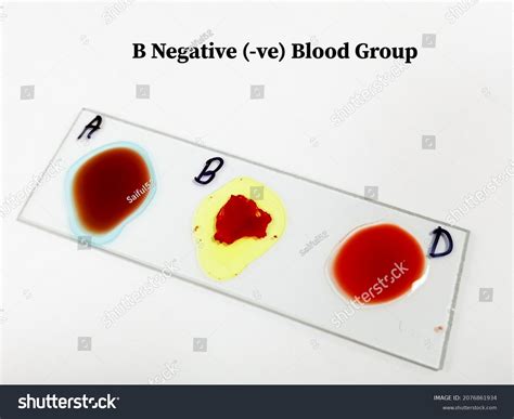 Image result for Agglutination Test