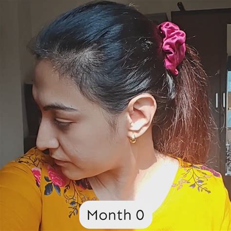 Arata Hair Growth Serum for Men and Women | For Fuller, Denser, Thicke