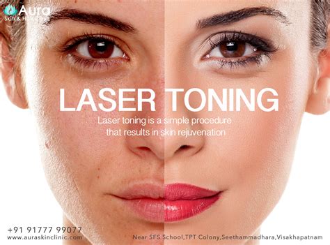 Aura Skin Clinic - Visakhapatnam: Laser Toning & Skin Pigmentation ...