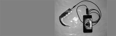 Smart Trach | Laryngoscope Lucknow | Disposable Medical Devices