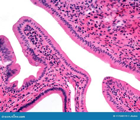 Simple Columnar Epithelium. Ampulla Of Vater Royalty-Free Stock ...
