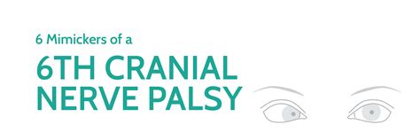 Cranial Nerve 6 Palsy