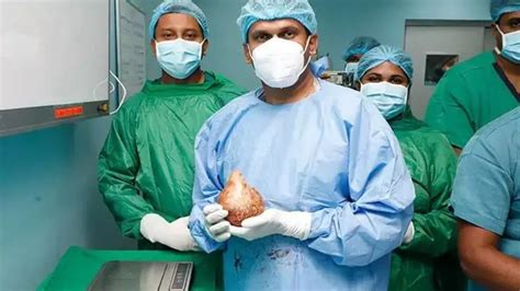Sri Lankan Patient’s 5.26-Inch Kidney Stone Breaks Guinness World ...