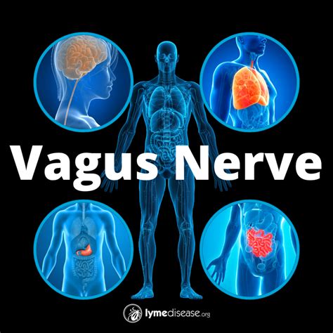 Post-Infectious Fatigue & Your Vagus Nerve | Madison Area Lyme Support Group