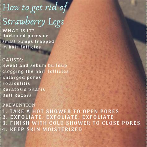 How to get rid of strawberry legs in 5 easy steps – Artofit