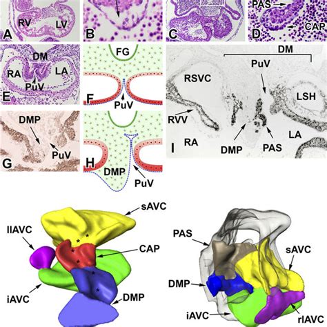 Image result for Heart Development Disorders