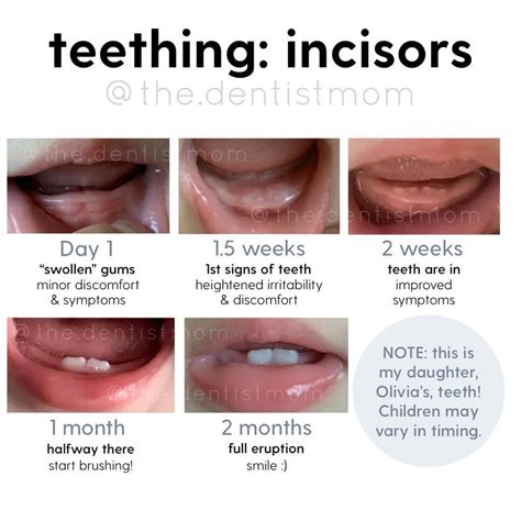 What does teething look like? : r/ParentingGraphics