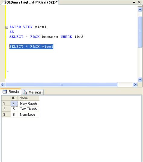 Image result for SQL Server How to View a View