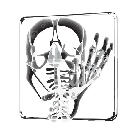 Hand Xray Vector, Sticker Clipart Hand With A Skeleton In 3d Stock Photo Cartoon, Sticker ...
