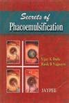Buy Secrets of Phacoemulsification Book Online at Low Prices in India ...
