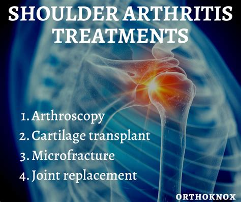 Shoulder Arthritis Treatments | OrthoKnox