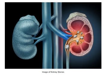 Image result for Implementation Science Road Map
