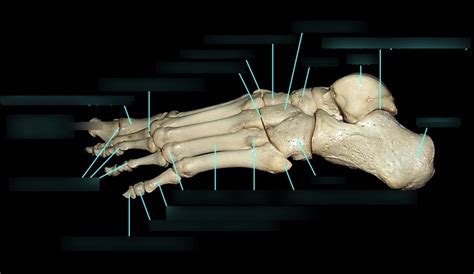 Image result for Toe Lateral View