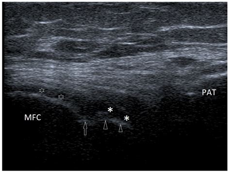Basic Differences and Most Common Findings in Ultrasound Examinations ...