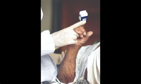 'In moderate cases, anticoagulants, steroids are mainstays of treatment'