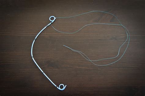 How is a ureteral stent removed? - KidneyStoners.org