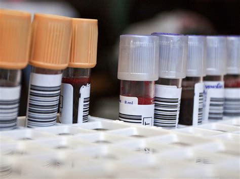 Síndrome de Down | BabyCenter