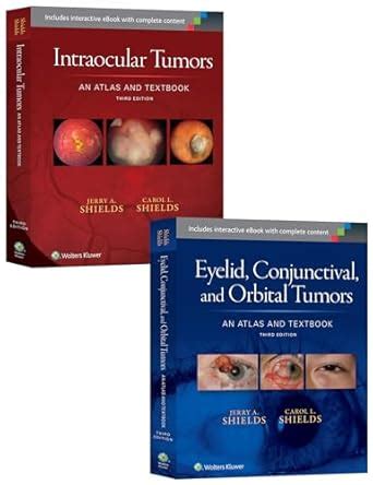 Buy Intraocular Tumors 3rd Ed. + Eyelid, Conjunctival, and Orbital ...