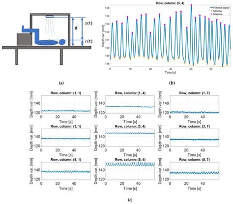 Depth-Sensing-Based Algorithm for Chest Morphology Assessment in ...