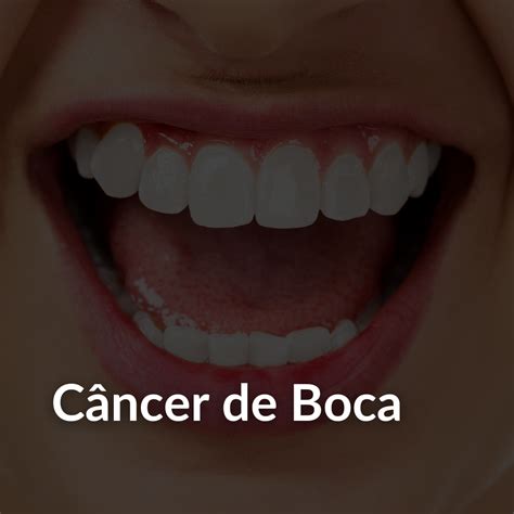 Câncer de Boca: O que é o câncer de boca? - Dra. Adriana Brasil - CRM ...
