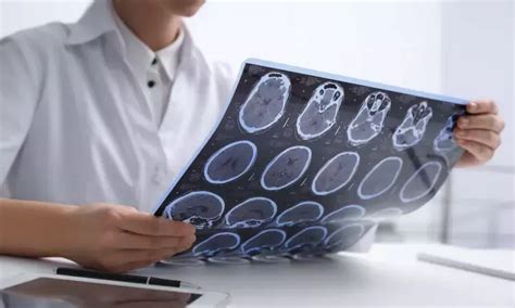 Teriflunomide may delay first clinical demyelinating event among ...