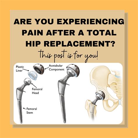 Pain After Total Hip Replacement - Orthowell Physical Therapy
