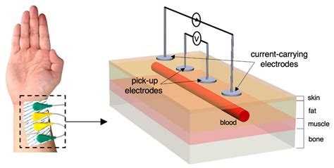 Towards Estimating Arterial Diameter Using Bioimpedance Spectroscopy: A ...