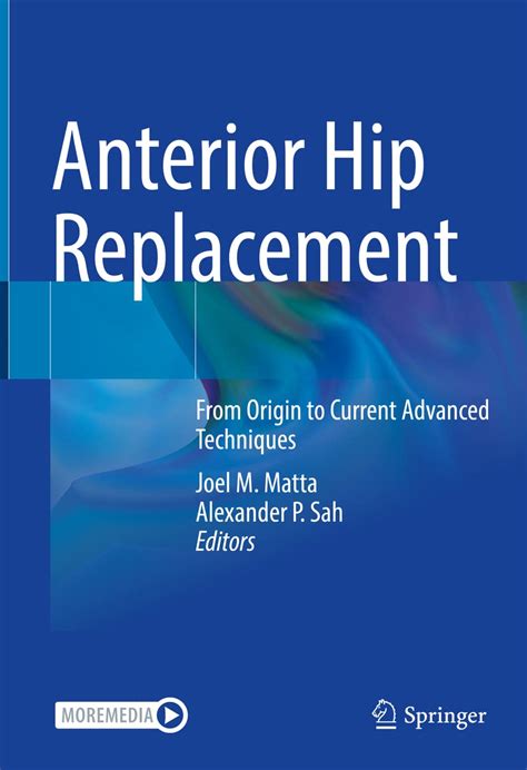 Buy Anterior Hip Replacement: From Origin to Current Advanced ...
