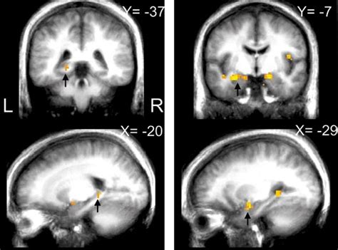 Brain Study Indicates Why Some Memories Persist : NPR