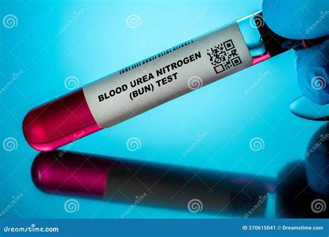 Bun Blood Test