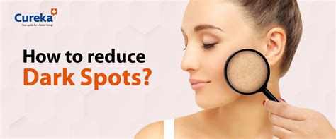 How to Reduce Dark Spots - Cureka
