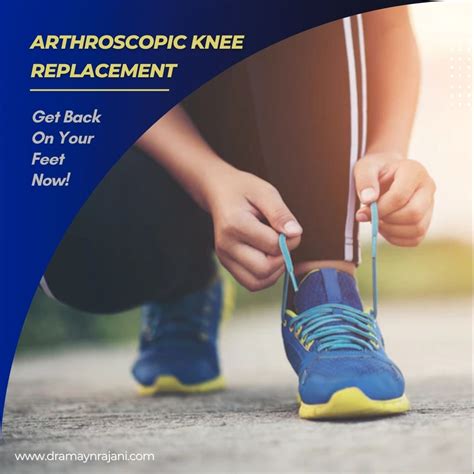 Arthroscopic Knee Replacement: Get Back On Your Feet Now!