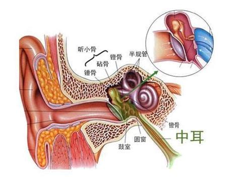 耳朵流脓怎么治？是什么原因导致？|化脓性中耳炎|中耳胆脂瘤|外耳道感染|耳朵|-健康界