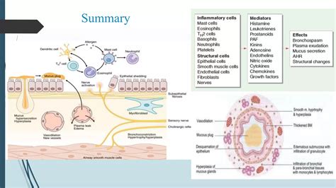 Pathogenesis of asthma | PPTX