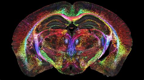 High Res Brain Scan Image 的图像结果