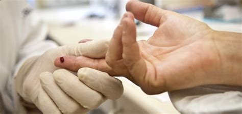 Image result for Method Using HIV Testing