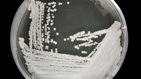 Bildergebnis für candida auris