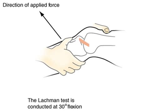 Image result for Lachman Testing