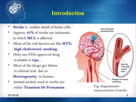 Screening model for stroke. | PPT